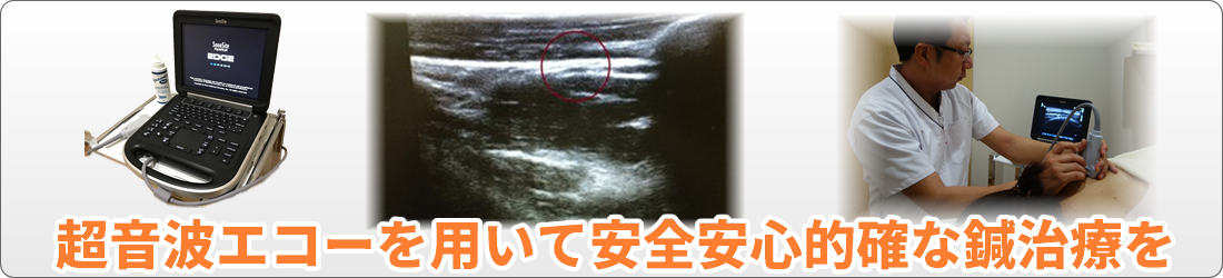 超音波エコーについて