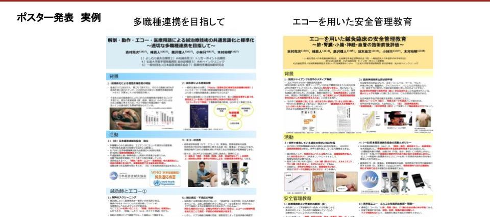 超音波エコーを用いて安心安全的確な 治療を提供します