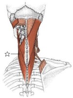 k114